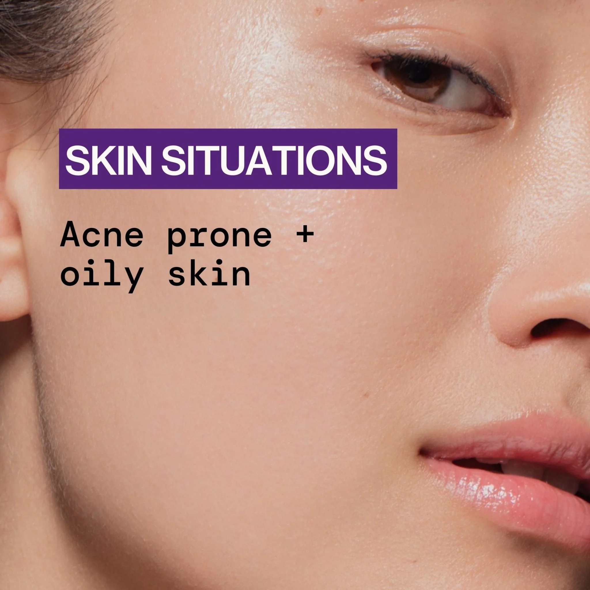 Acne Defense Face Wash - Image 8